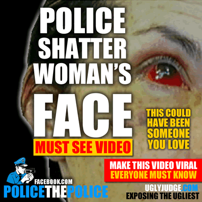chicago skokie police assault woman and shatter her face for doing nothing